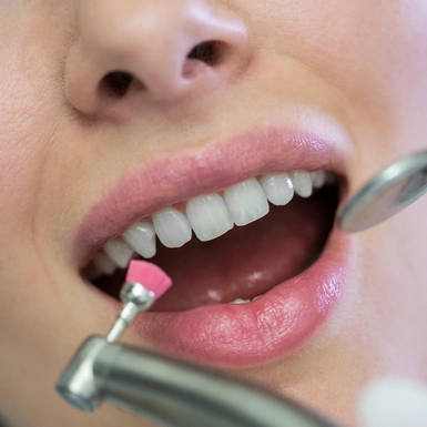 Акция на комплексную чистку зубов